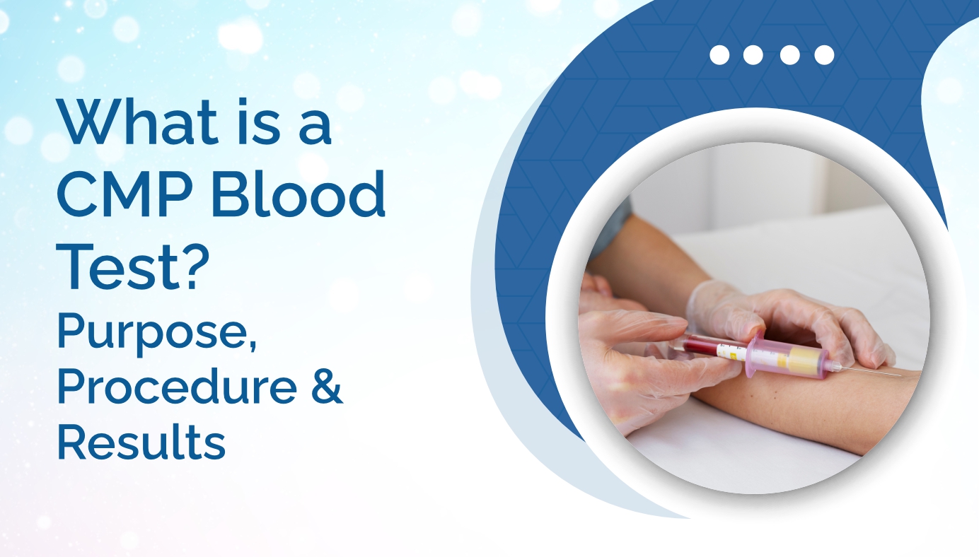 What is a CMP Blood Test? Purpose, Procedure & Results
